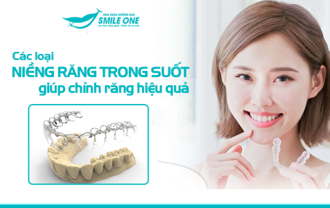 Các loại niềng răng trong suốt giúp chỉnh răng hiệu quả 
